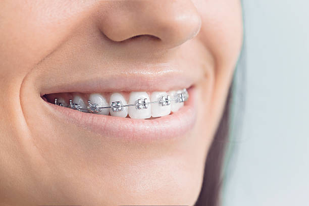Best Dental Fillings (Composite and Amalgam)  in Redondo Beach, CA